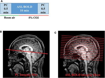 Quantitative Cerebrovascular Reactivity in Normal Aging: Comparison Between Phase-Contrast and Arterial Spin Labeling MRI